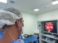 Tumor na hipófise – cirurgia por vídeo na Santa Casa trata tumores da base do crânio